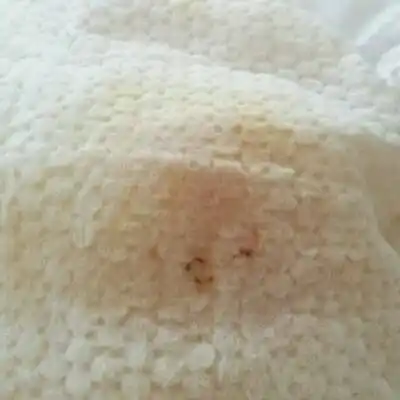 裤前面就是小鸡鸡那有褐色或血色分泌物 是怎麼回事儿 尿很黄_宝宝树