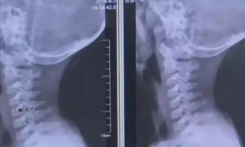 男童玩手机变歪头宝宝这玩意正在毁掉你的孩子