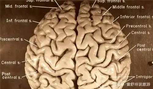 那个偷走"爱因斯坦大脑",并切成240块的人,研究出了什么