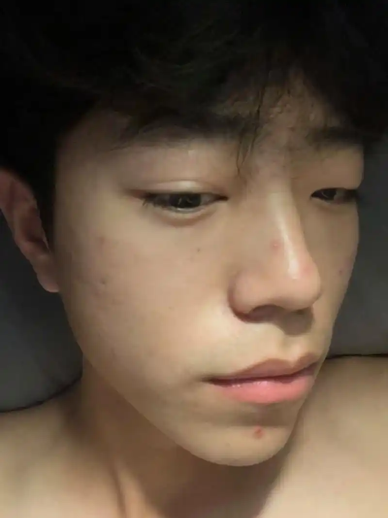 再也回不到就算长痘也很帅的19岁了