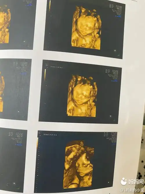 今天去查了,有小唧唧男孩,做四维医生说,脸像我,身高像我老公肯定好