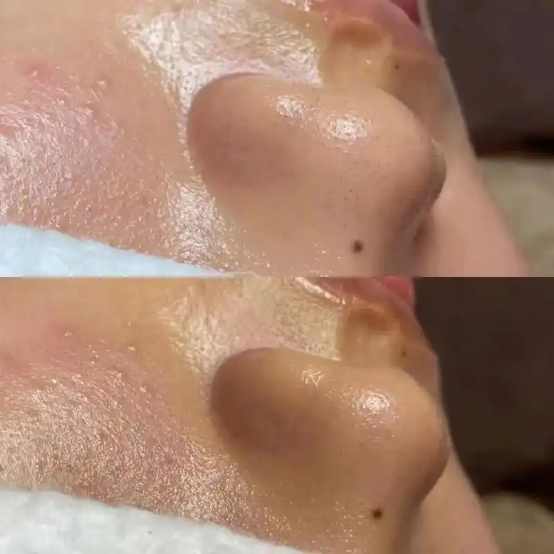 真实记录.#深层毛孔清洁  普通清洁只是用洗面奶,洗掉皮肤表 - 抖音