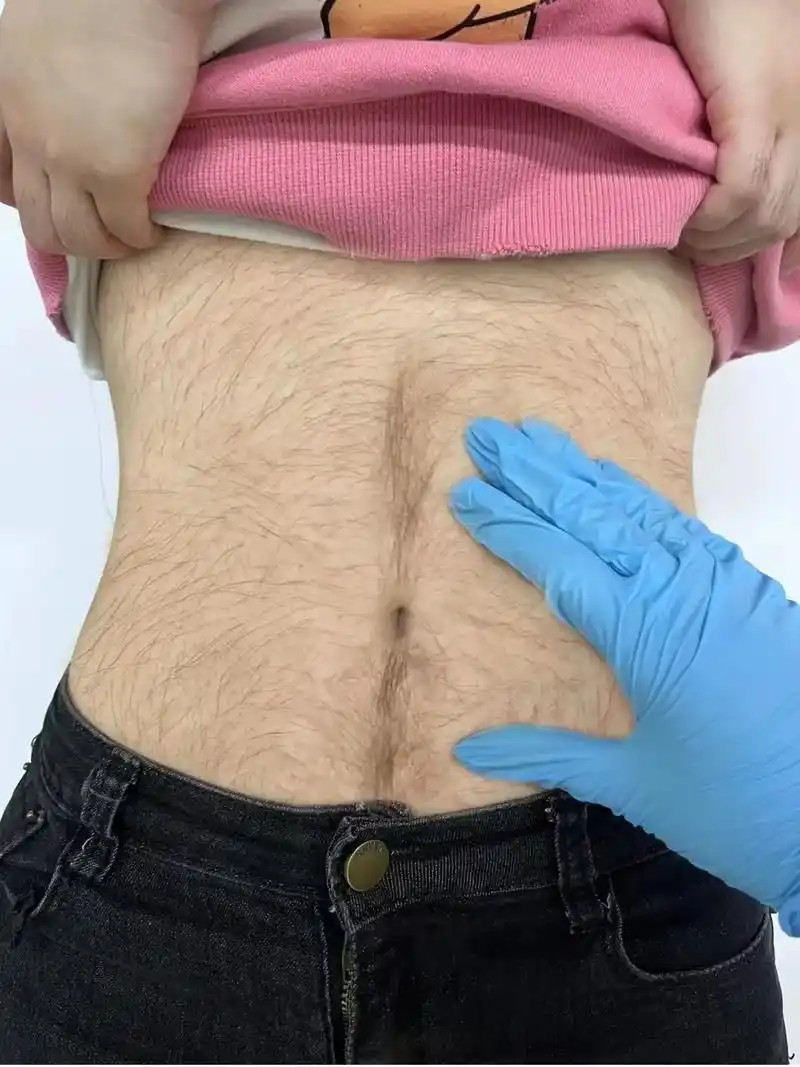 已排雷求汗毛多的姐妹快刷到我