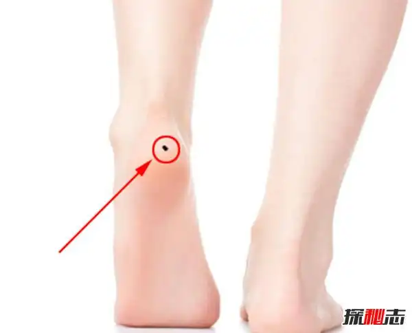 必须取的十大凶痣(图解)