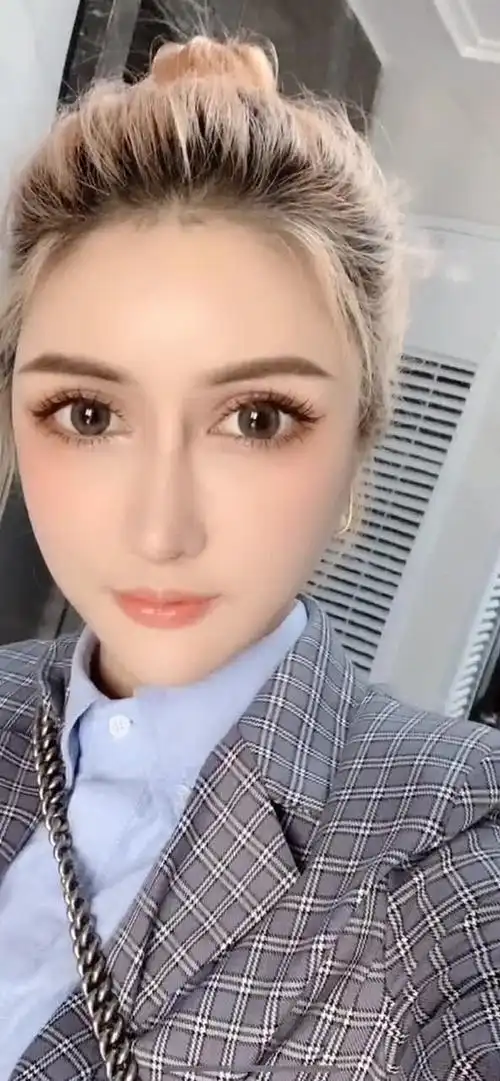 芭比双眼皮术后三个月,妩媚动人宛若天生,你喜欢吗?