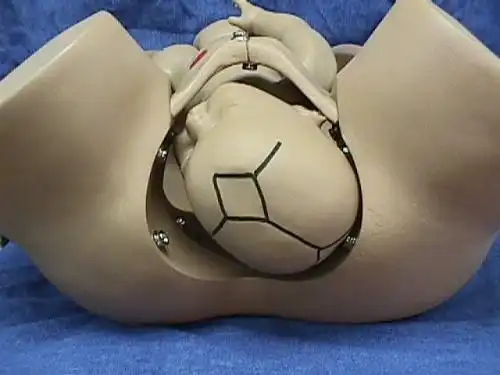 35w产检归来,bc胎位lot,是不是多半不能顺了? 新找来些胎位照片图示