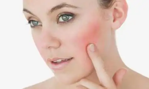 想要美白的敏感肌肤为什么皮肤总是发红发痒