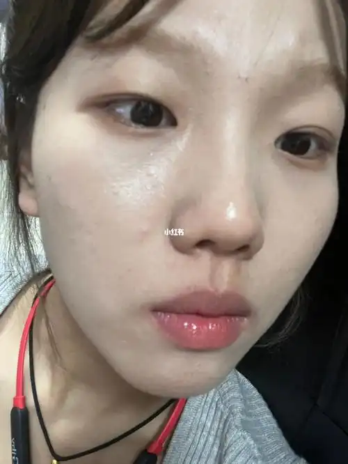 皮肤状态好差该如何修复啊家人们