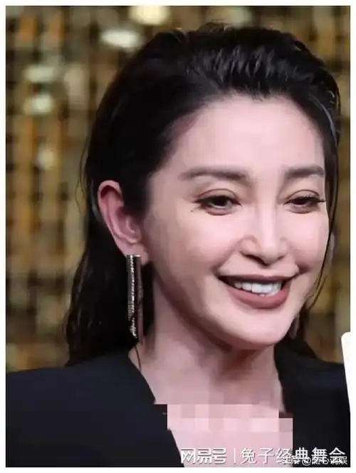 医美就像熨斗,熨平了皱纹也烫肿了脸|董洁|大s|刘晓庆|高圆圆|李冰冰