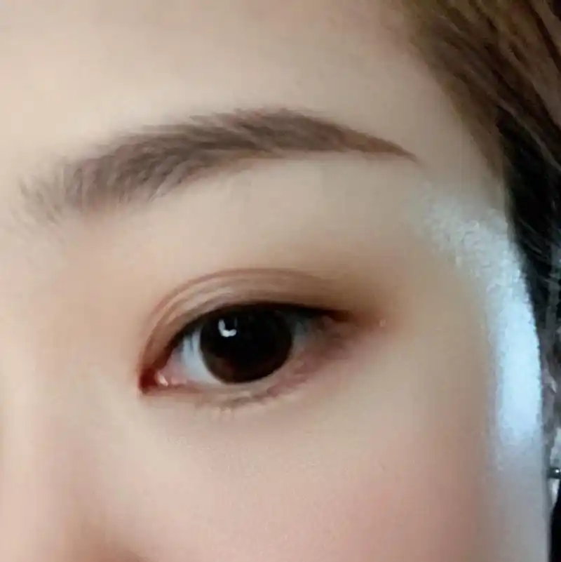 看我的多层眼皮