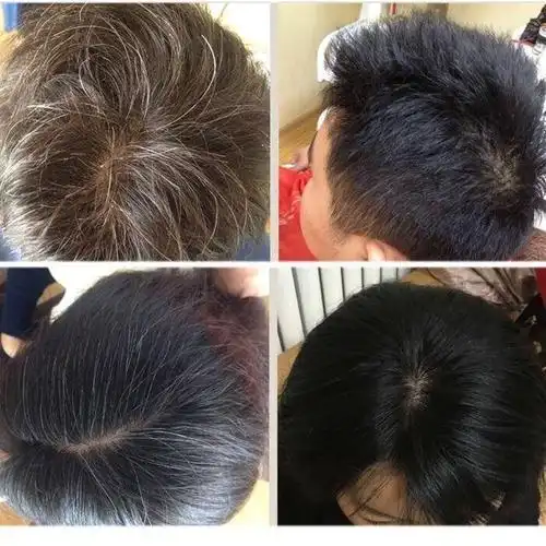 何首乌中草药洗发水白头发转黑发中老年产后白发乌发防脱养发液zzh