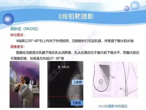 对比增强能谱乳腺x线摄影