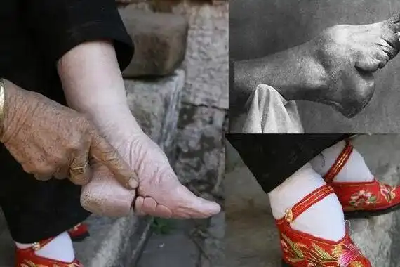 为什么古人喜欢缠三寸金莲小脚(缠足对女性伤害有多大)-秒懂啦