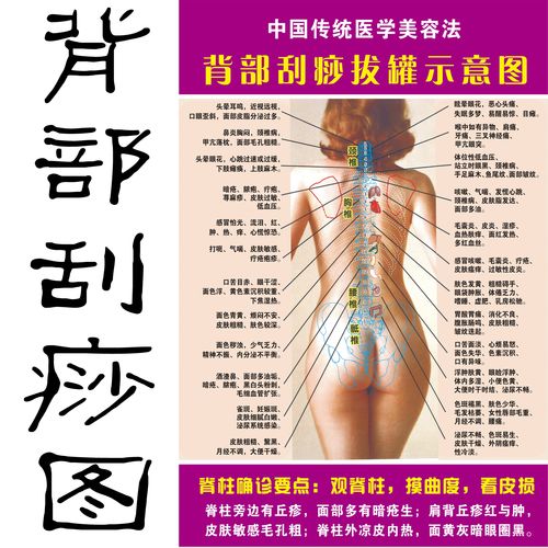 人体穴位挂图中医养生馆宣传海报 女背部刮痧示意图 脊背诊断贴画