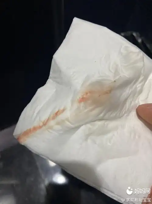 5月29排卵同房,排卵第8天有出血