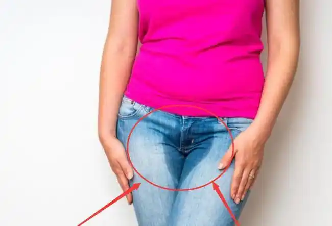 女生白带过多裤子容易湿医生牢记这3点轻松远离窘境