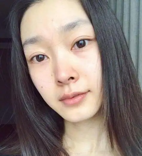 把宋轶早期和现在的照片进行对比,还是差别很大的.