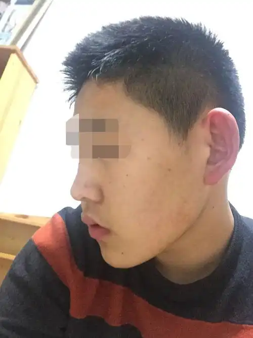 我的侧脸难看吗?我比较胖,鹳骨有点突