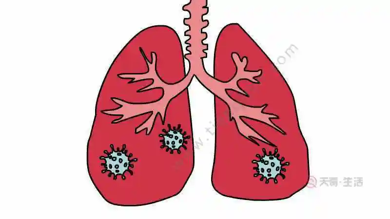 肺炎症状简笔画