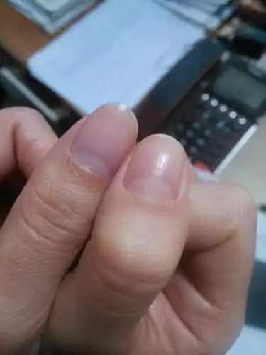 请问这两个指甲颜色那个正常一点?