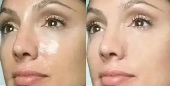 都说"一白遮百丑",皮肤黯黄的人怎么才能变白?