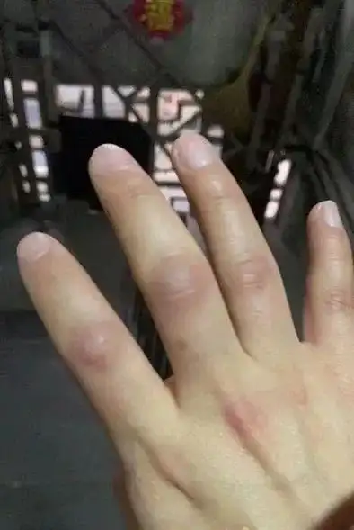 联防联控 莲湖在行动|一天半敲门300多户 手指关节敲肿了!