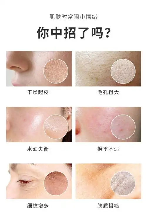 仁和维生素e乳液ve男女面部护肤乳保湿缓解皮肤干燥3瓶装