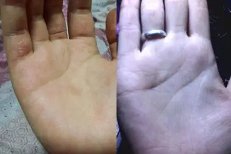 【图】婚姻线断开代表着什么 为你分析你的爱情运