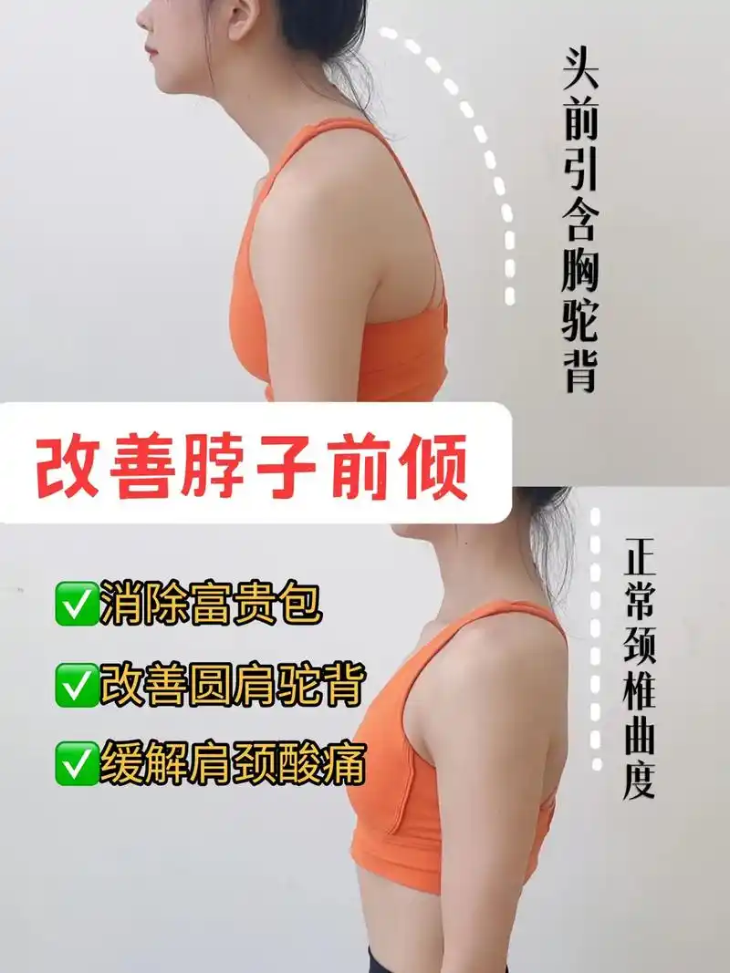 七个动作拯救脖子前倾,改善圆肩驼背头前引,改善富贵包,打造气 - 抖音