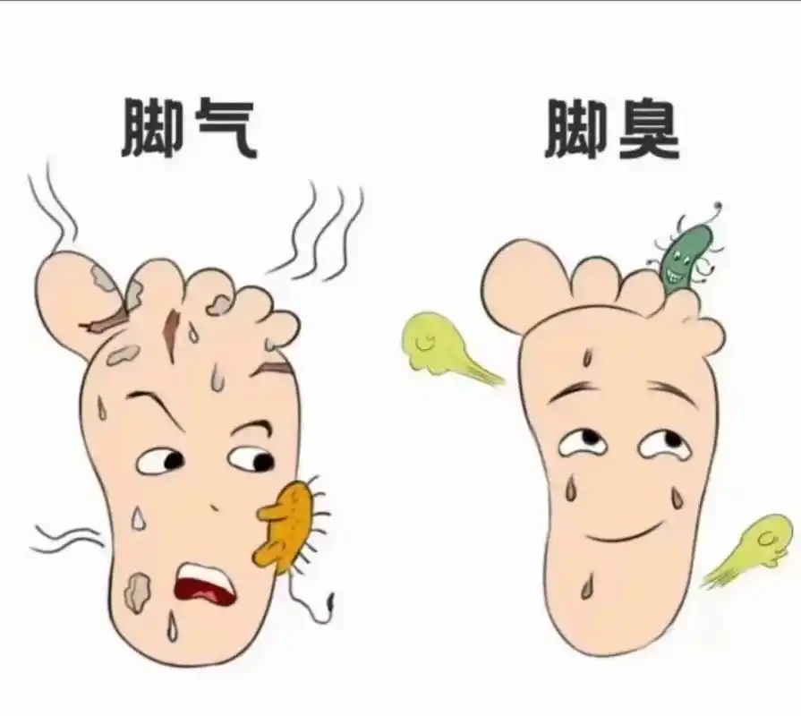 脚臭,脚痒,会指甲,夏天来了穿凉鞋真尴尬.你有没有这样的烦恼 - 抖音