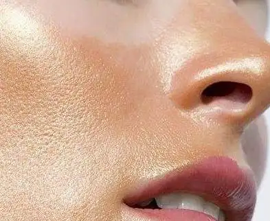 面部皮肤油腻怎么办