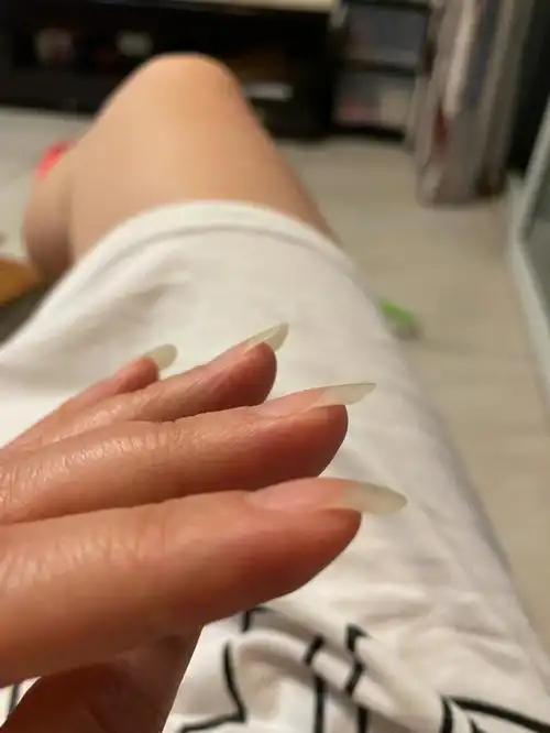 指甲长得太快,一不留神就这样了,娃爸老是念叨我指甲太长
