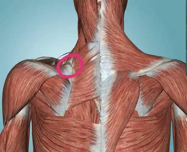 肩胛骨上角疼痛的致病因素