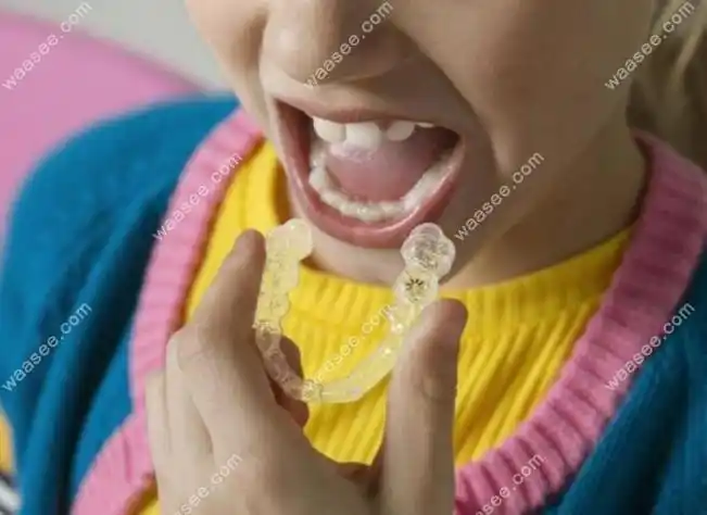 12岁儿童牙齿矫正费用这有不清楚孩子戴牙套多少钱的看这