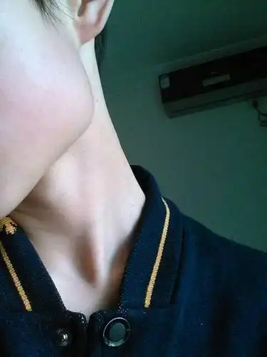 拿什么拯救我下颚的脸型.(男13岁)