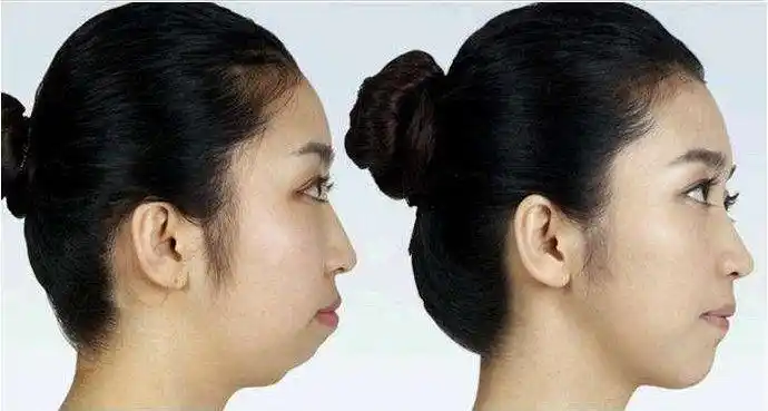 拉低你颜值的可能不是你的鼻子你的眼很有可能是你的牙