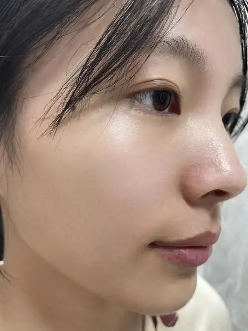 去痘印78我好像悟到了7575