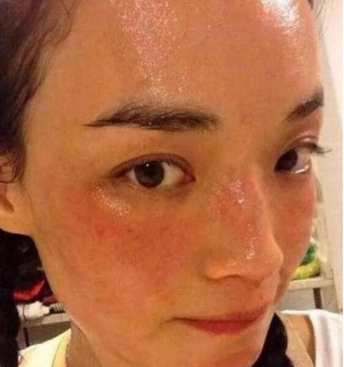 女星素颜长这样?林心如全是黄褐斑,孙怡秒变路人