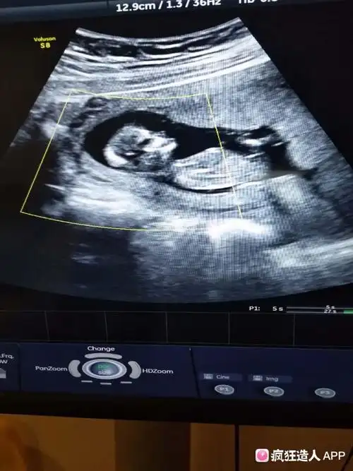 nt 顺利通过,不知道是男宝还是女宝