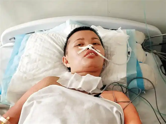 女子车祸重伤昏迷30天