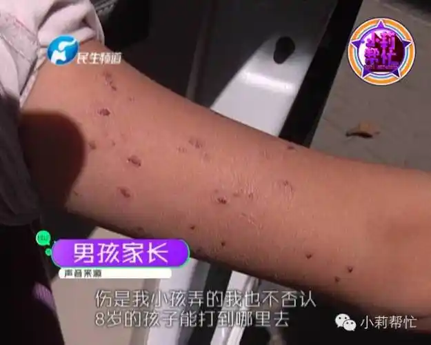 30多个指甲血印!郑州8岁女孩在学校经历了什么?