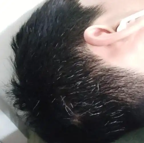 我这白头发算多吗?