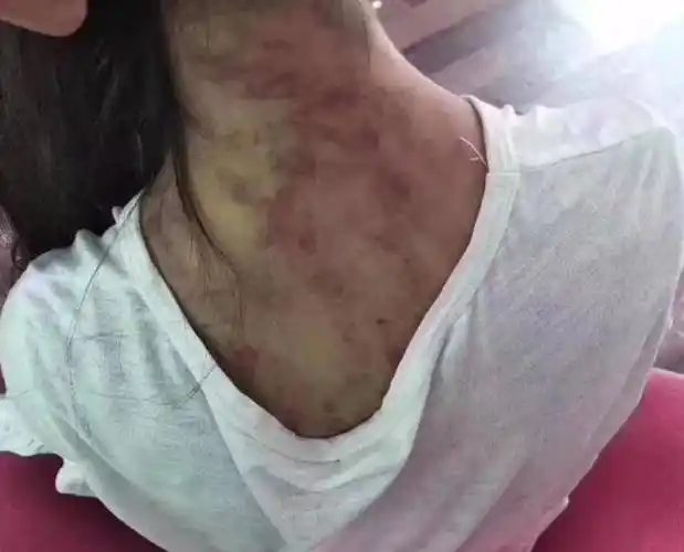 青海妈妈燕志云:虐待6岁女儿致死,7年后出狱,挖出女儿骨灰泄愤_苏丽