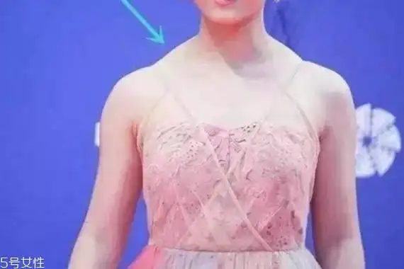 斜方肌怎么消除消除斜方肌最快的方法