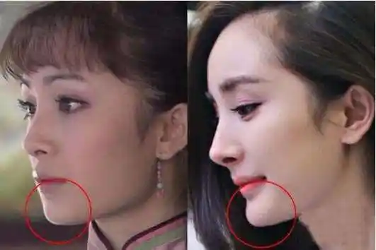 杨幂整形前后对比(杨幂整形前后对比照)