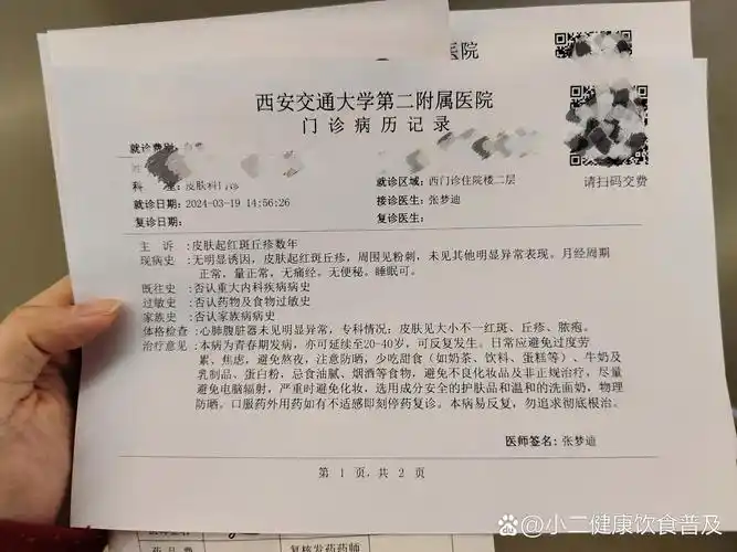 爆痘西安交大二附院皮肤科