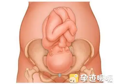 孕晚期,胎宝宝入盆是一种怎样的体验?