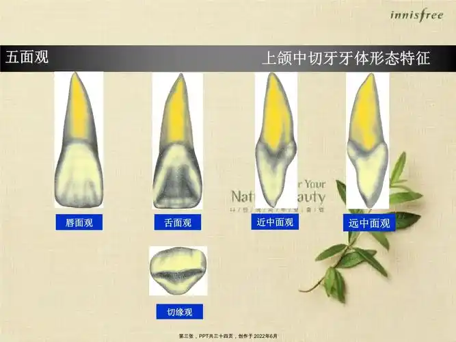 上颌中切牙形态特征简述_第3页