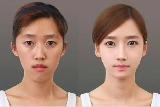 韩国整容术到底多强大?网友:不服都不行
