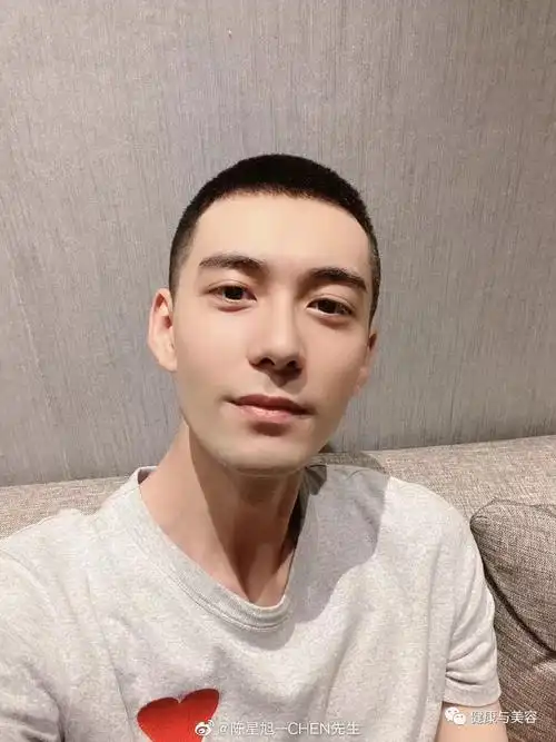 李易峰陈星旭剪寸头难看的m型发际线如何避免